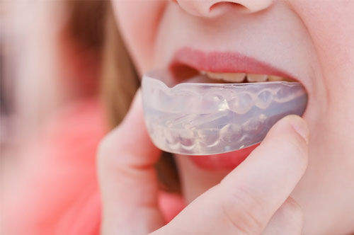Keep Your Teeth Safe While Enjoying Active Summer Days